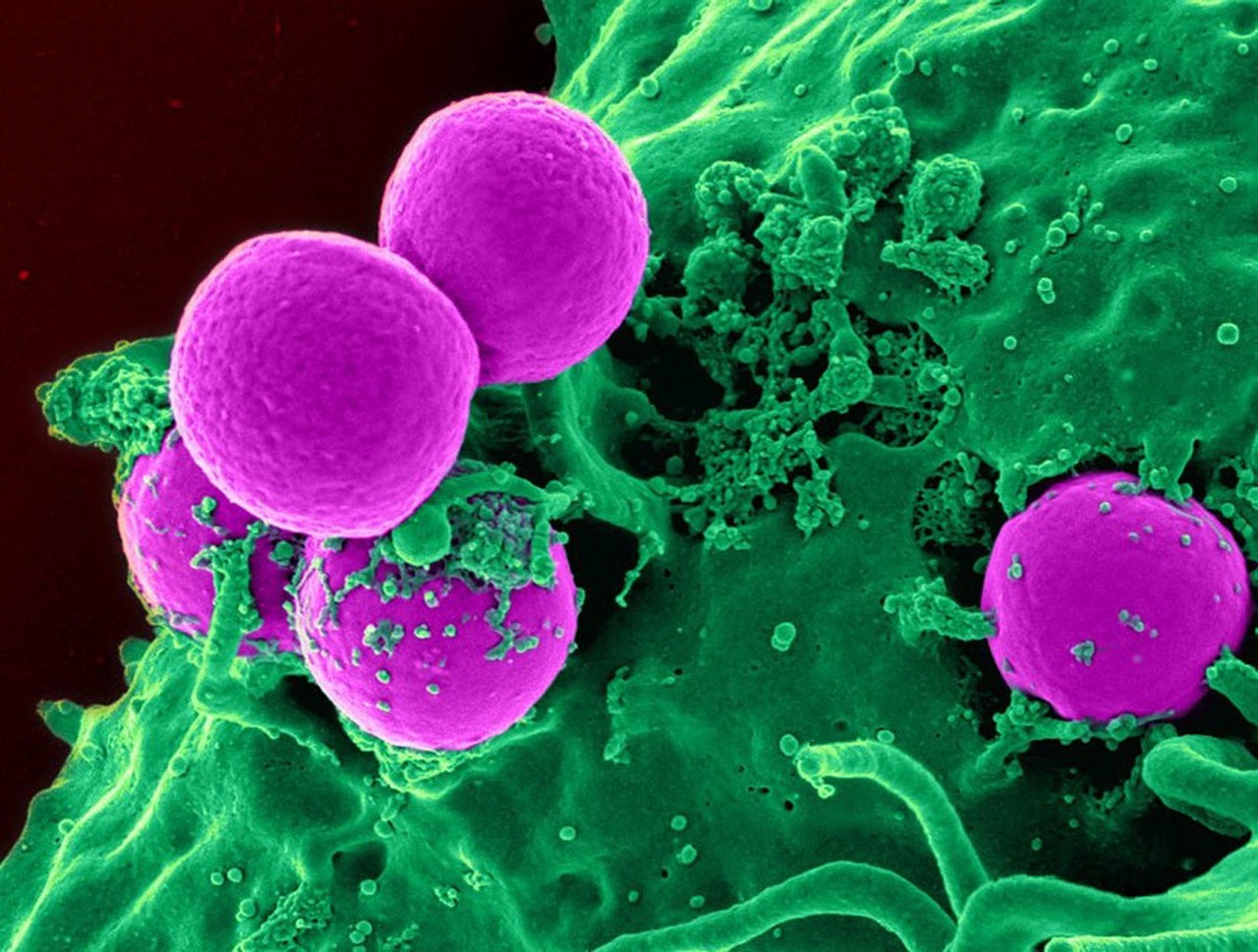 Antibiotics used in livestock feed are giving rise to antibiotic-resistant bacteria such as MRSA (methicillin-resistant Staphylococcus aureus), seen above. Credit: iStock